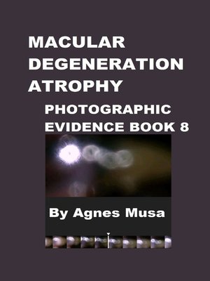 cover image of Macular Degeneration, Photographic Evidence Book 8